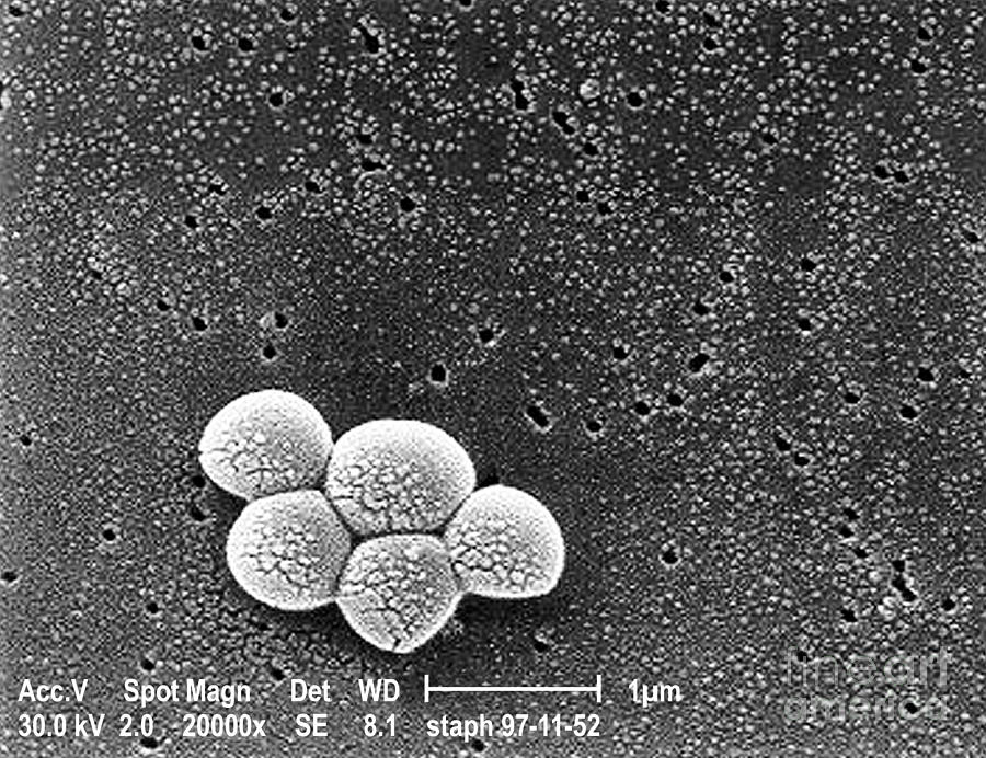 Methicillin-resistant Staphylococcus #30 Photograph by Science Source