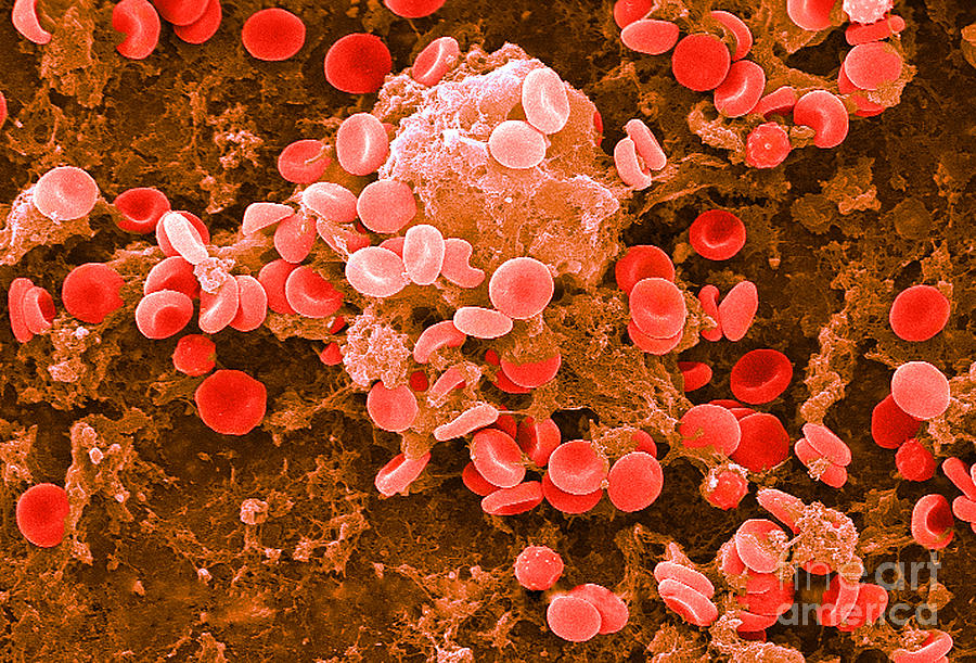 Biology Photograph - Red Blood Cells, Sem #30 by Science Source