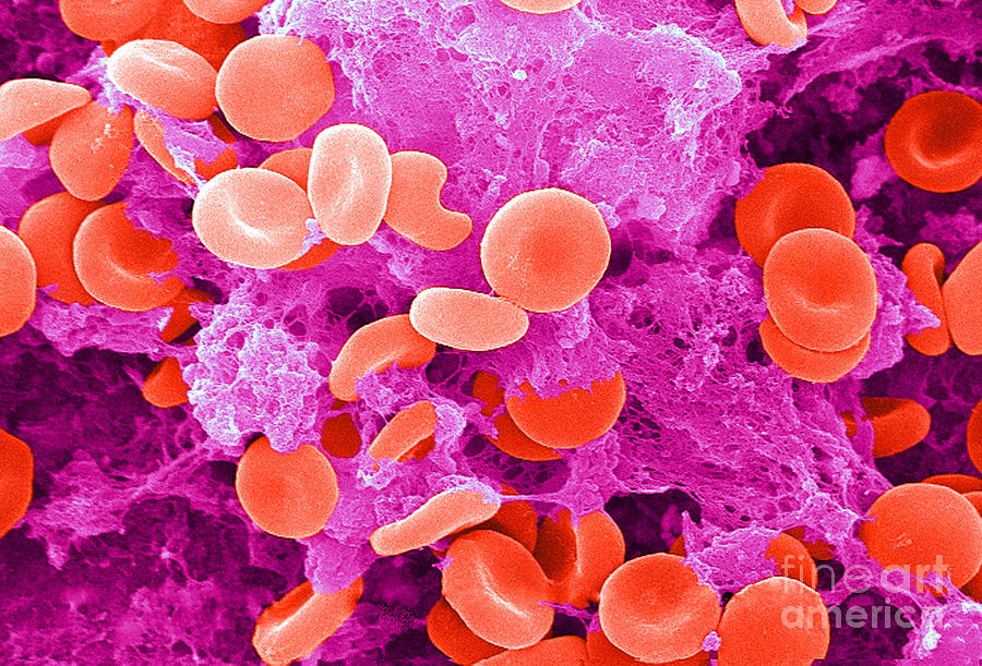 Red Blood Cells, Sem #32 Photograph by Science Source
