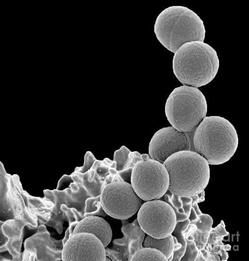 Methicillin-resistant Staphylococcus #33 Photograph by Science Source