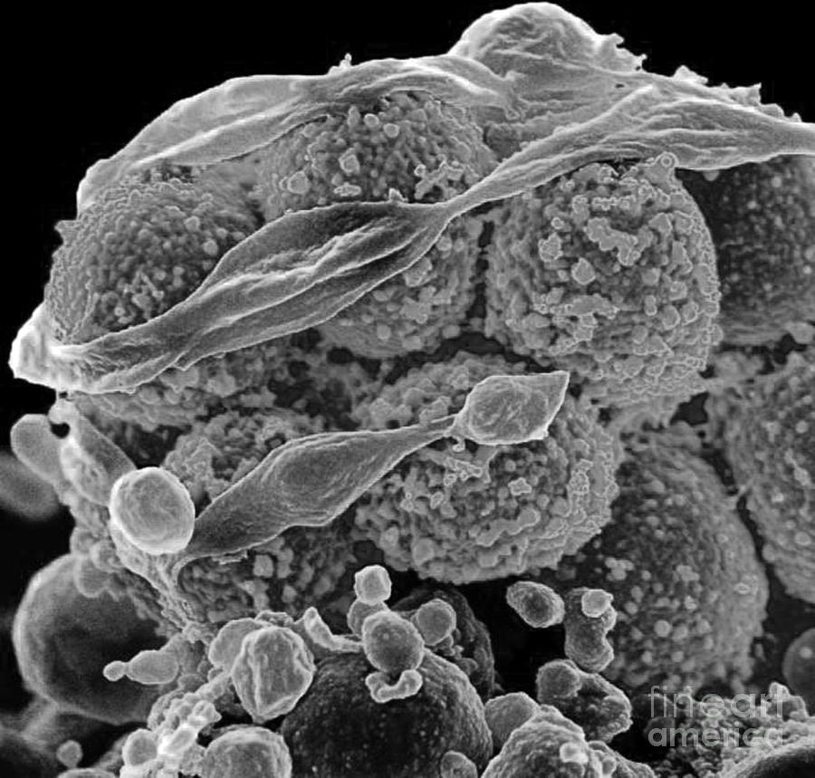 Methicillin-resistant Staphylococcus #34 Photograph by Science Source