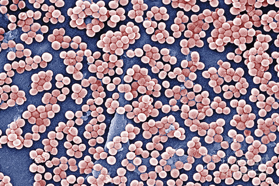 Methicillin-resistant Staphylococcus #39 Photograph by Science Source
