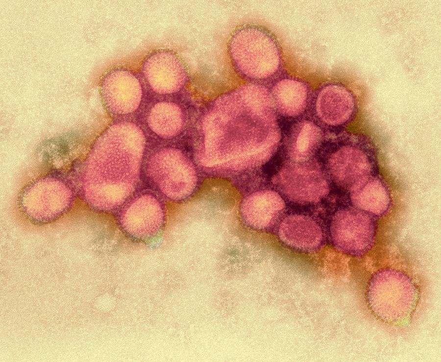 2009 H1n1 Swine Flu Virus, Tem Photograph by Ami Images - Fine Art America