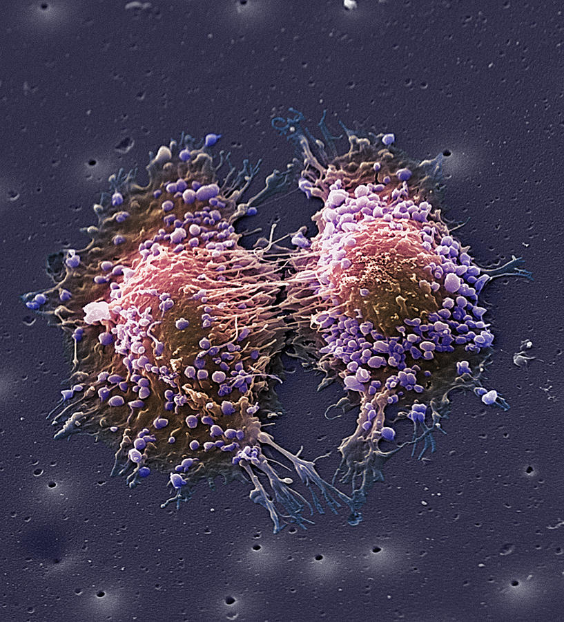 Cancer Cell Division Photograph By Steve Gschmeissner