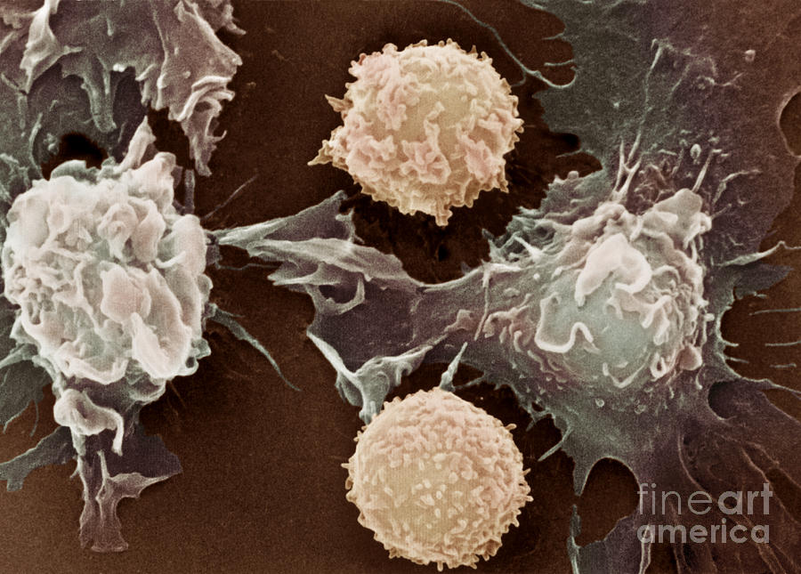 Cancer Cells #5 Photograph by Science Source