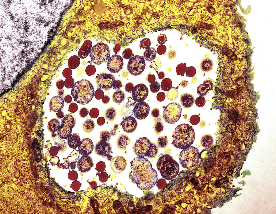 Chlamydia Trachomatis Bacteria Tem Photograph By Biomedical Imaging Unit Southampton General 6106