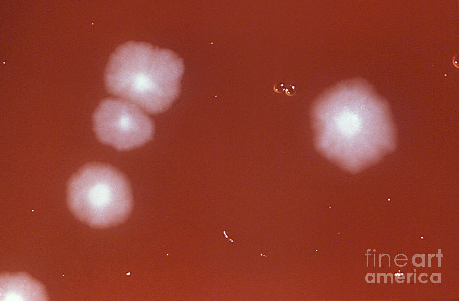 Clostridium Difficile #4 Photograph by Science Source