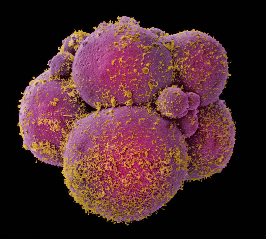 Coloured Sem Of Human Embryo At 8-cell Stage Photograph by Dr Yorgos ...