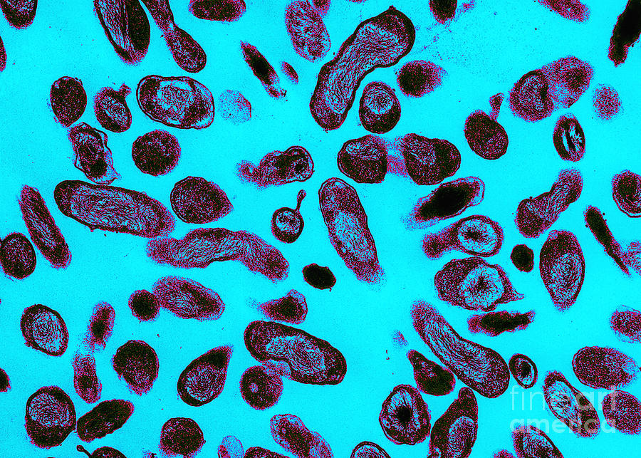 Coxiella Burnetii Bacteria, Tem #4 Photograph by Science Source