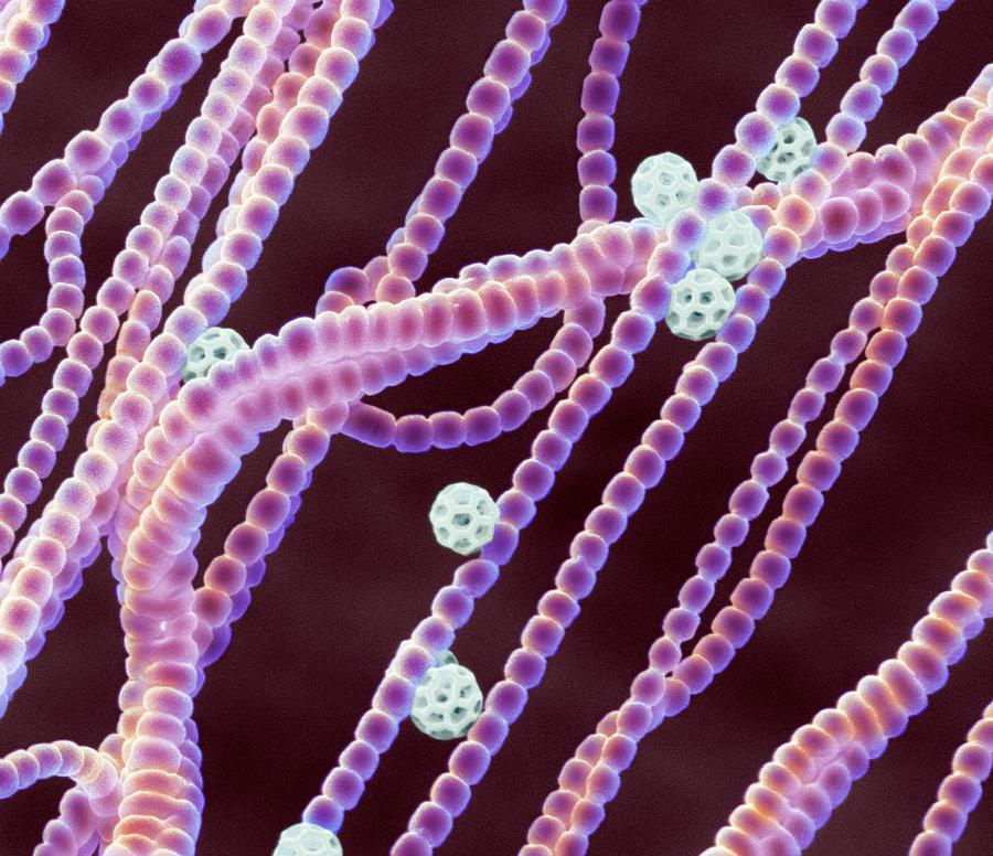 Cyanobacteria, Sem #4 Photograph by Steve Gschmeissner