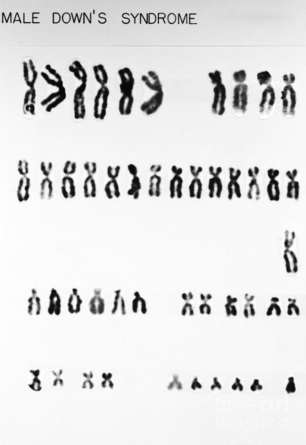 Downs Syndrome Karyotype #4 Photograph by Omikron