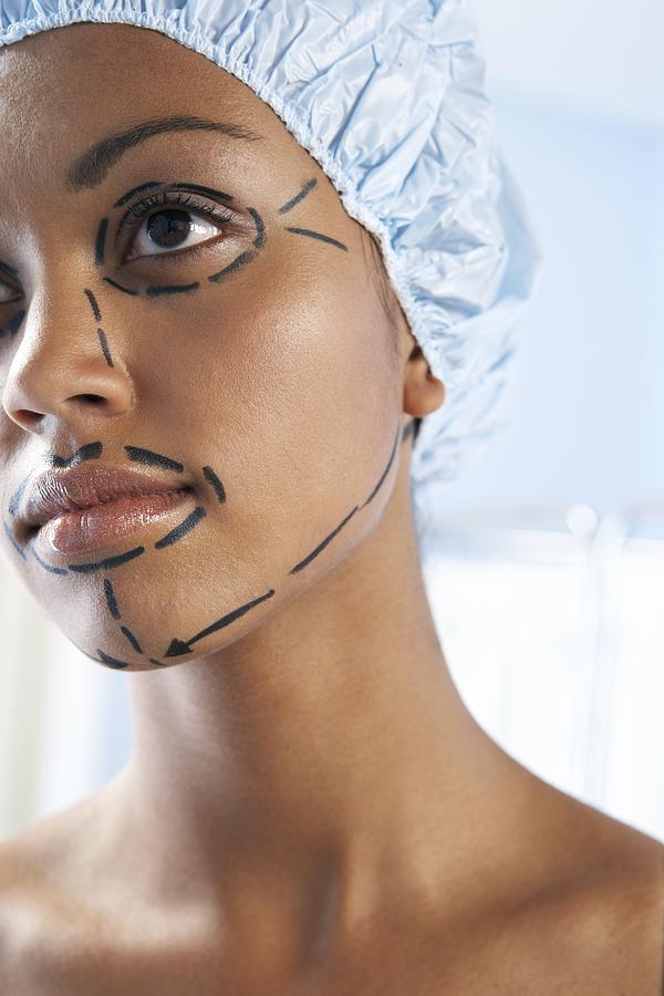 Human Photograph - Facelift Surgery Markings #4 by Adam Gault