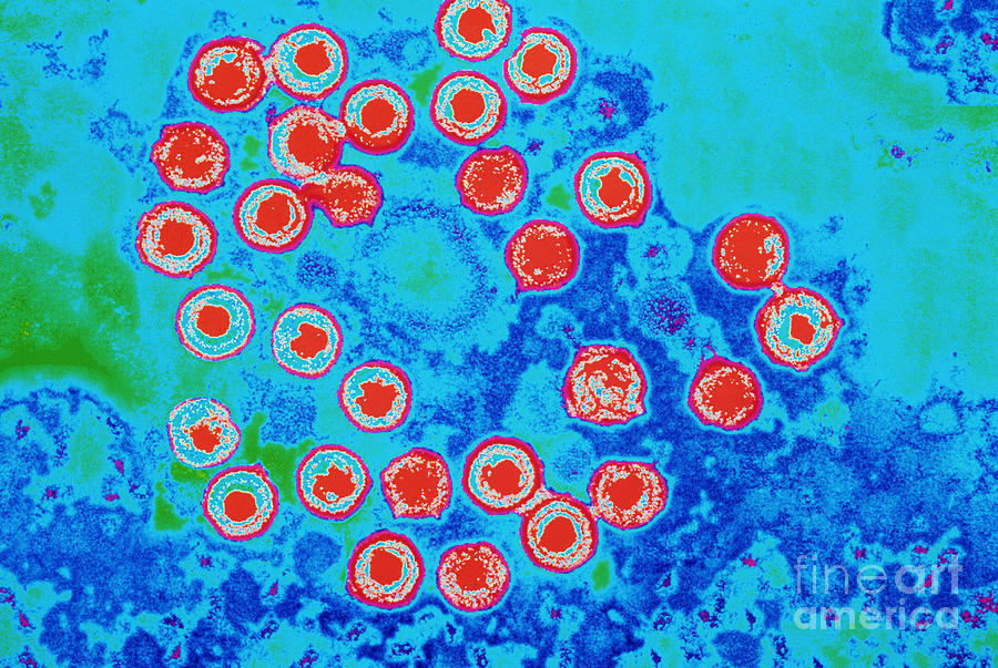 Herpes Simplex Virus #4 Photograph by Science Source