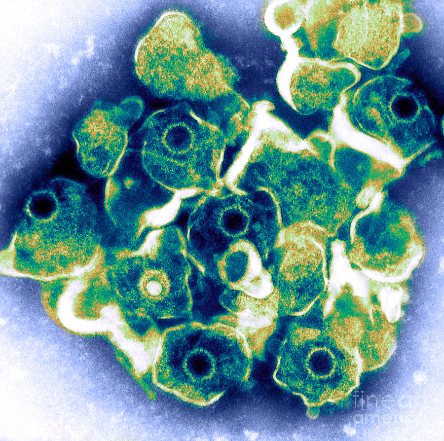 Herpes Simplex Virus Tem #4 Photograph by ASM/Science Source