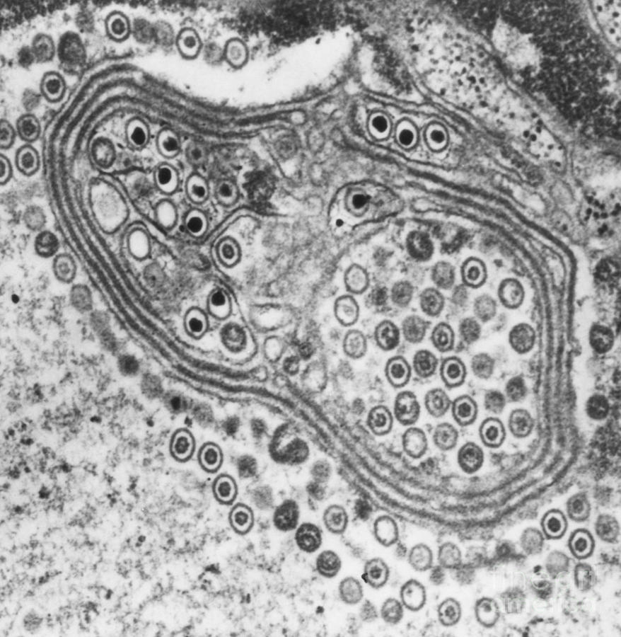 Herpes Simplex Virus, Tem #4 Photograph by Science Source