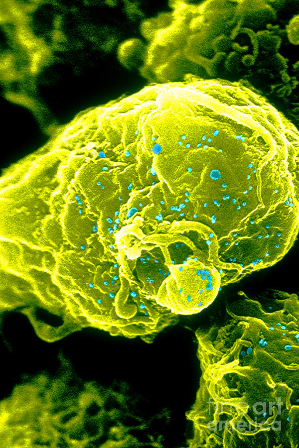 Hiv-1 Infected T4 Lymphocyte Sem #4 Photograph by Science Source