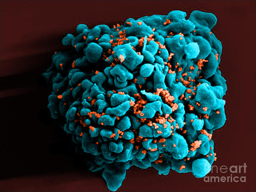 Hiv-infected H9 T Cell, Sem #4 Photograph by Science Source