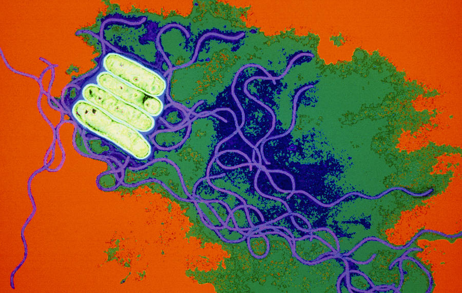 Legionella Bacteria 4 By Dr Linda Stannard Uct