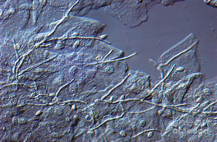 Lm Of Candida Albicans #4 Photograph by M. I. Walker