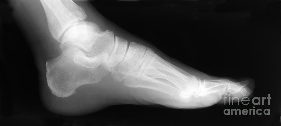 Human Foot Photograph - Normal Human Foot #4 by Ted Kinsman