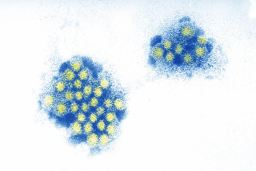 Norwalk Virus, Tem #4  by Science Source