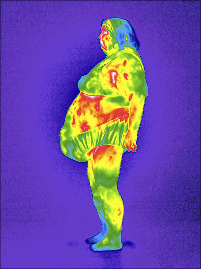 Human Photograph - Obese Woman, Thermogram #4 by Tony Mcconnell