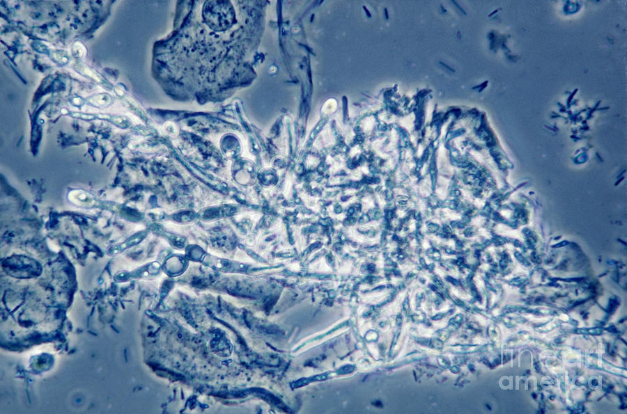4 Phase Contrast- Candida Albicans Photograph by M. I. Walker