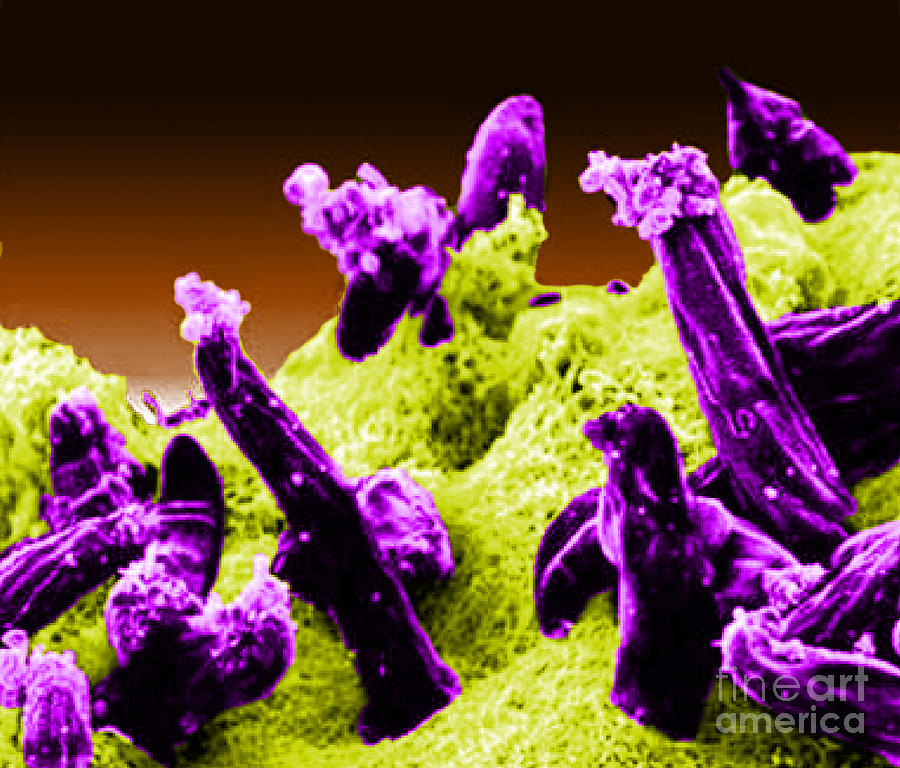 Plasmodium Gallinaceum, Sem #4 Photograph by Science Source