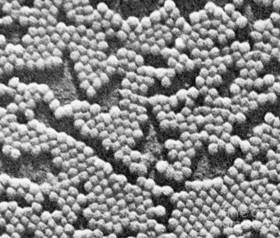 Polio Virus, Tem #4 Photograph by Omikron