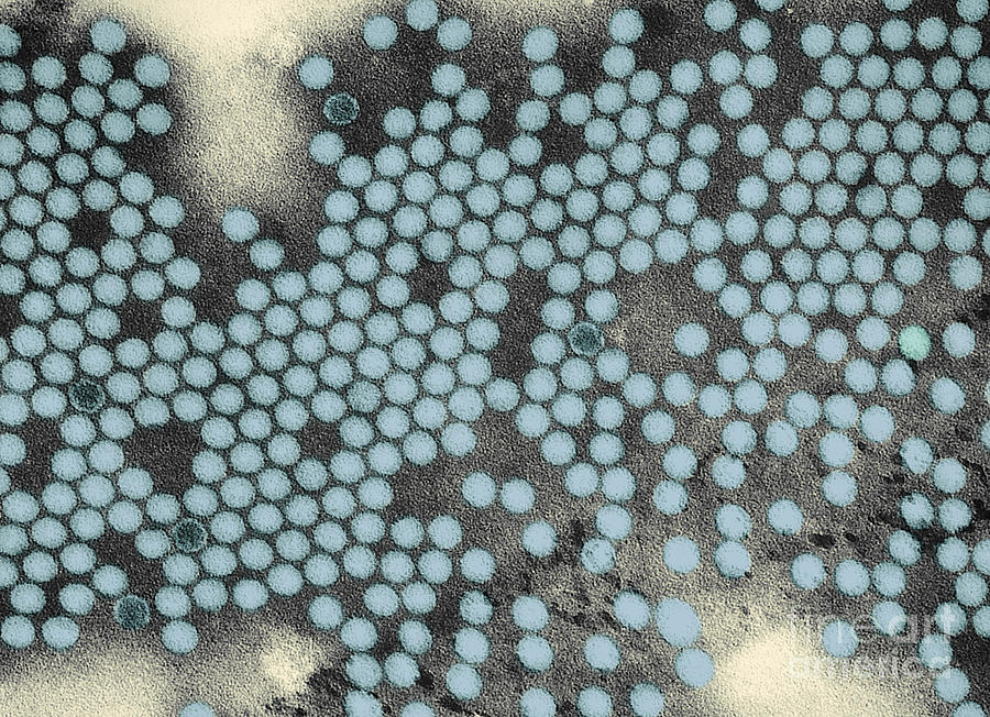 Poliovirus, Tem #4 Photograph by Science Source