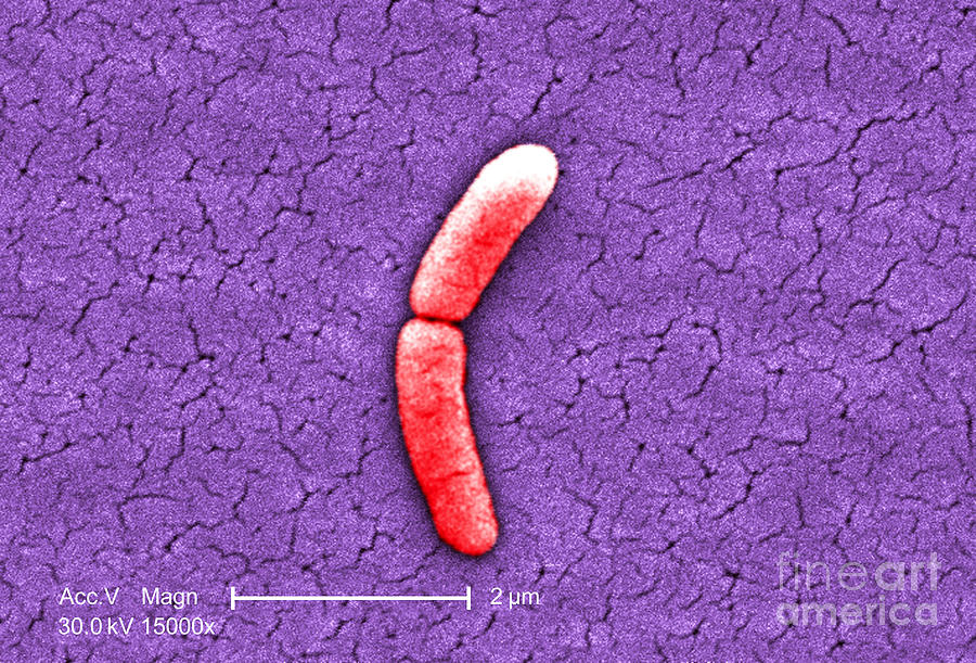 Salmonella, Sem #4 Photograph by Science Source