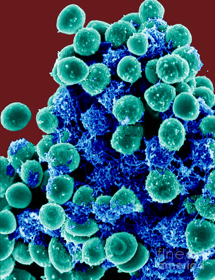 Staphylococcus Epidermidis Bacteria Sem Photograph By Science Source