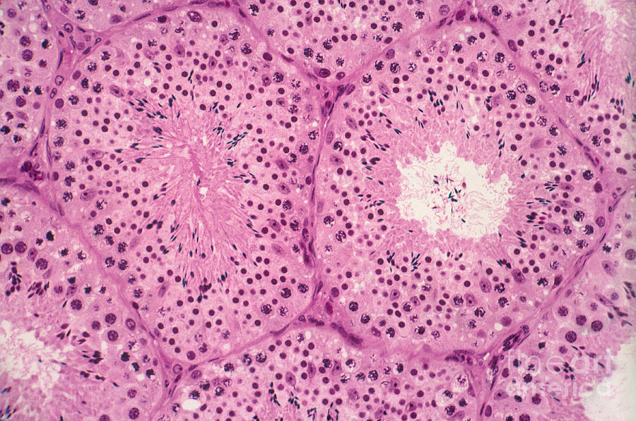 Testis Of A Monkey Lm #4 Photograph by M. I. Walker
