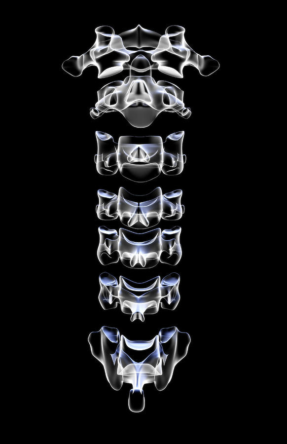 The Cervical Vertebrae #4 Digital Art by MedicalRF.com