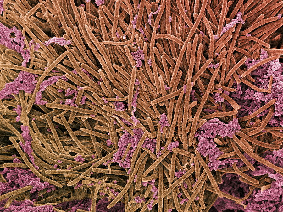 Micro-organisms Photograph - Tongue Bacteria, Sem #4 by Steve Gschmeissner