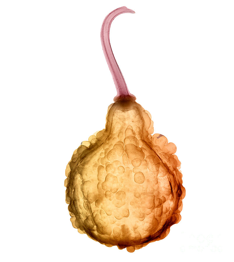 X-ray Of Fall Decorative Gourd #6 Photograph by Ted Kinsman