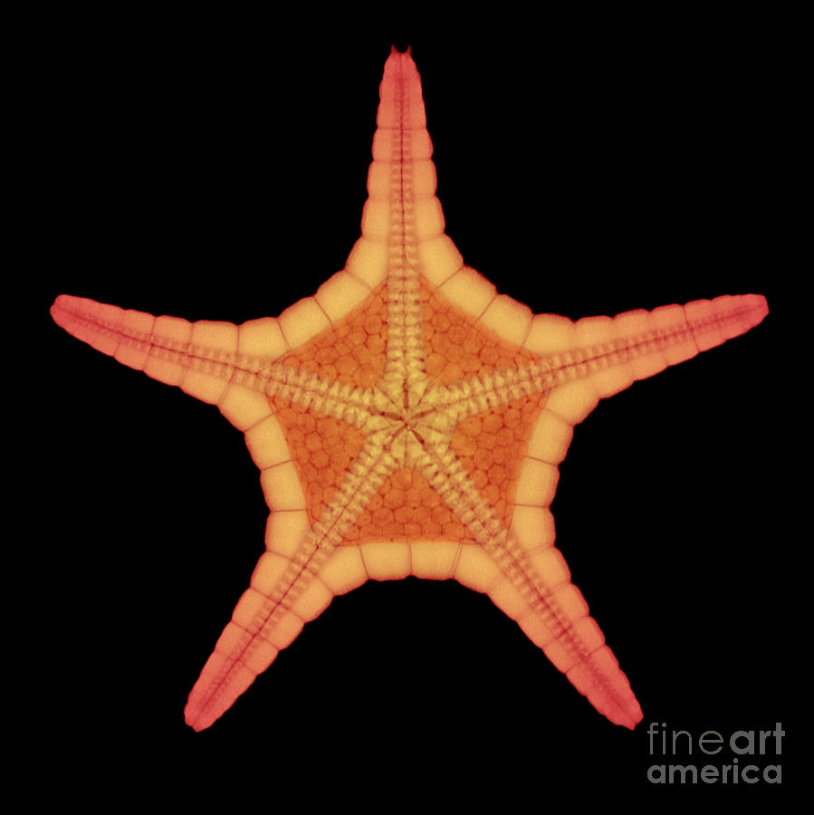 X-ray Of Starfish #10 Photograph by Ted Kinsman