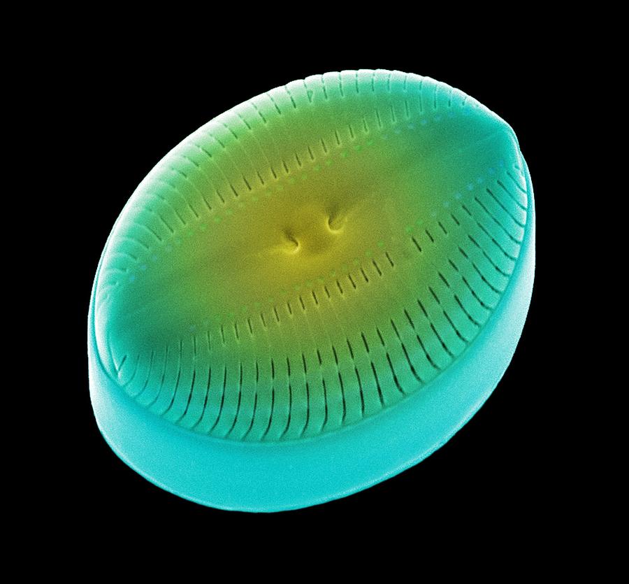 Nature Photograph - Diatom Alga, Sem #40 by Steve Gschmeissner