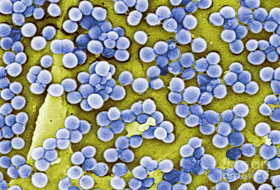Methicillin-resistant Staphylococcus #40 Photograph by Science Source