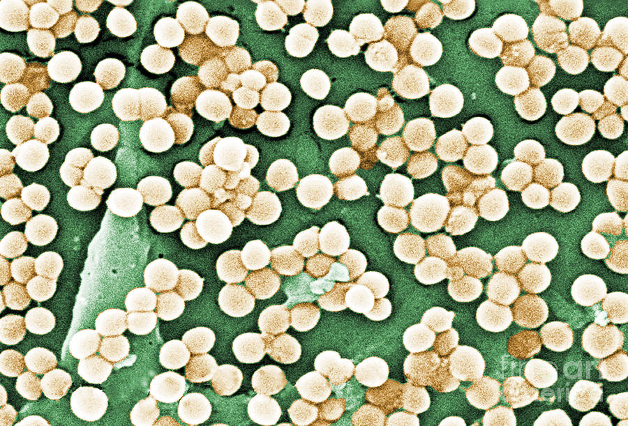 Methicillin-resistant Staphylococcus #42 Photograph by Science Source