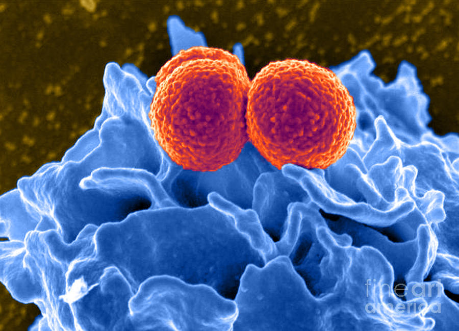 Methicillin-resistant Staphylococcus #45 Photograph by Science Source