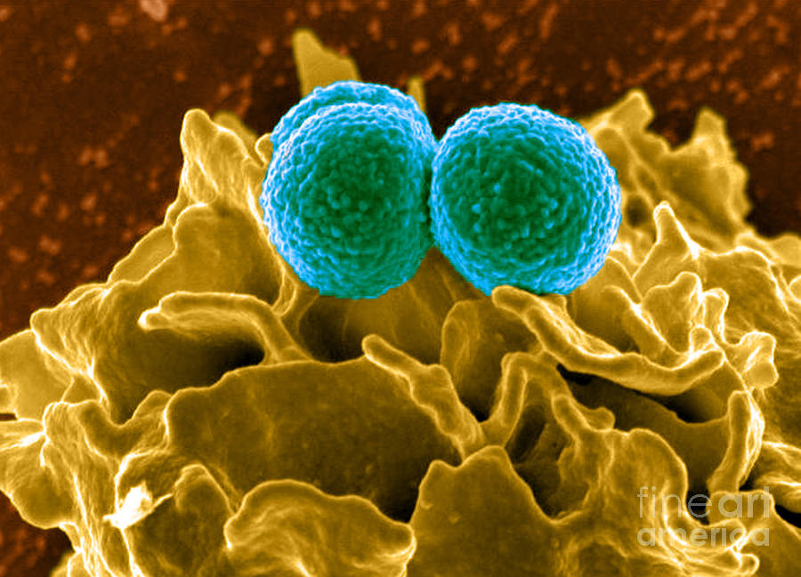 Methicillin-resistant Staphylococcus Photograph By Science Source - Pixels