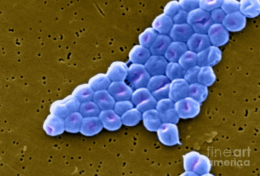 Acinetobacter Baumannii, Sem #5 Photograph by Science Source