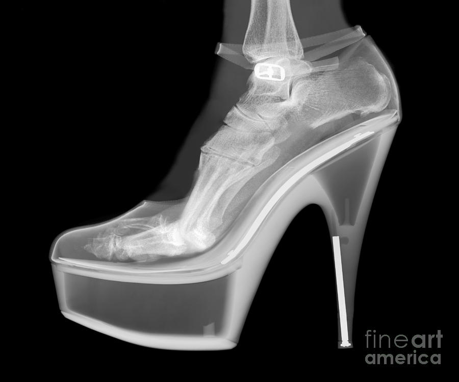 An Xray Of A Foot In A High Heel Shoe Photograph by Ted Kinsman Pixels