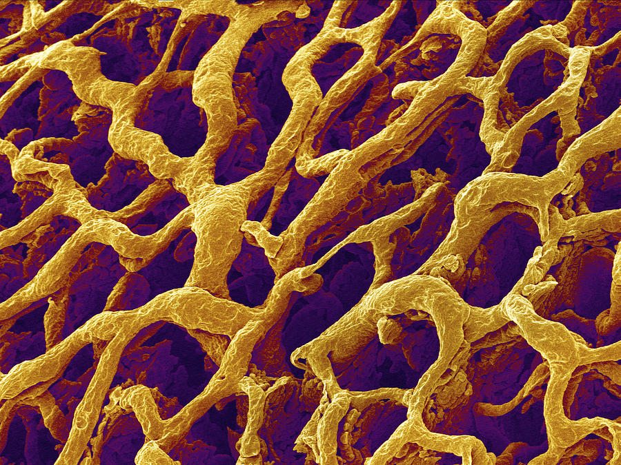 Blood Vessel Photograph - Blood Vessels In The Stomach Wall, Sem #5 by Susumu Nishinaga
