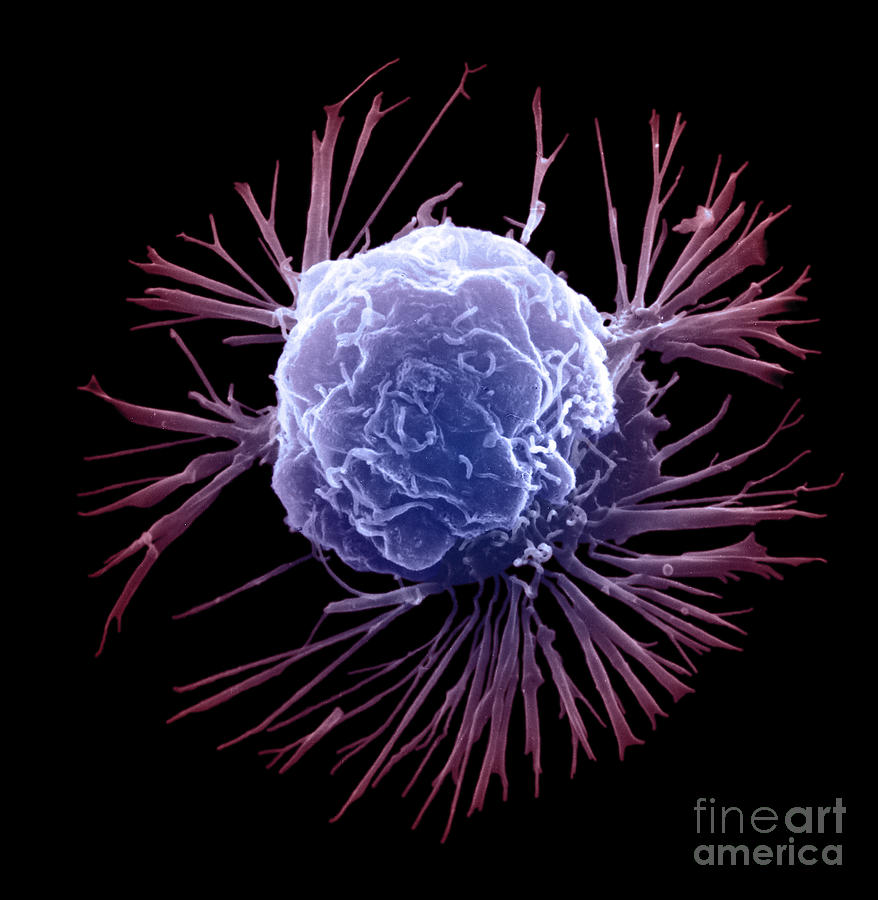 Breast Cancer Cell #2 Photograph by Science Source