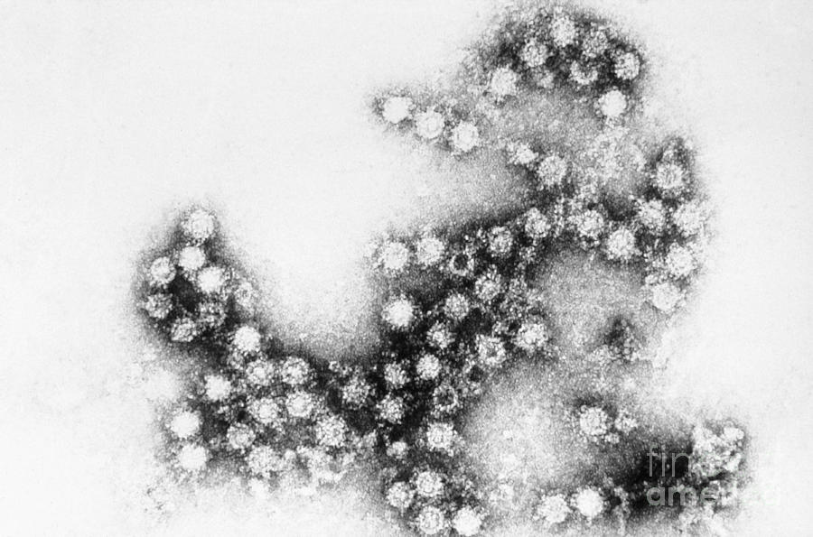 Coxsackie B4 Virus, Tem #5  by Science Source