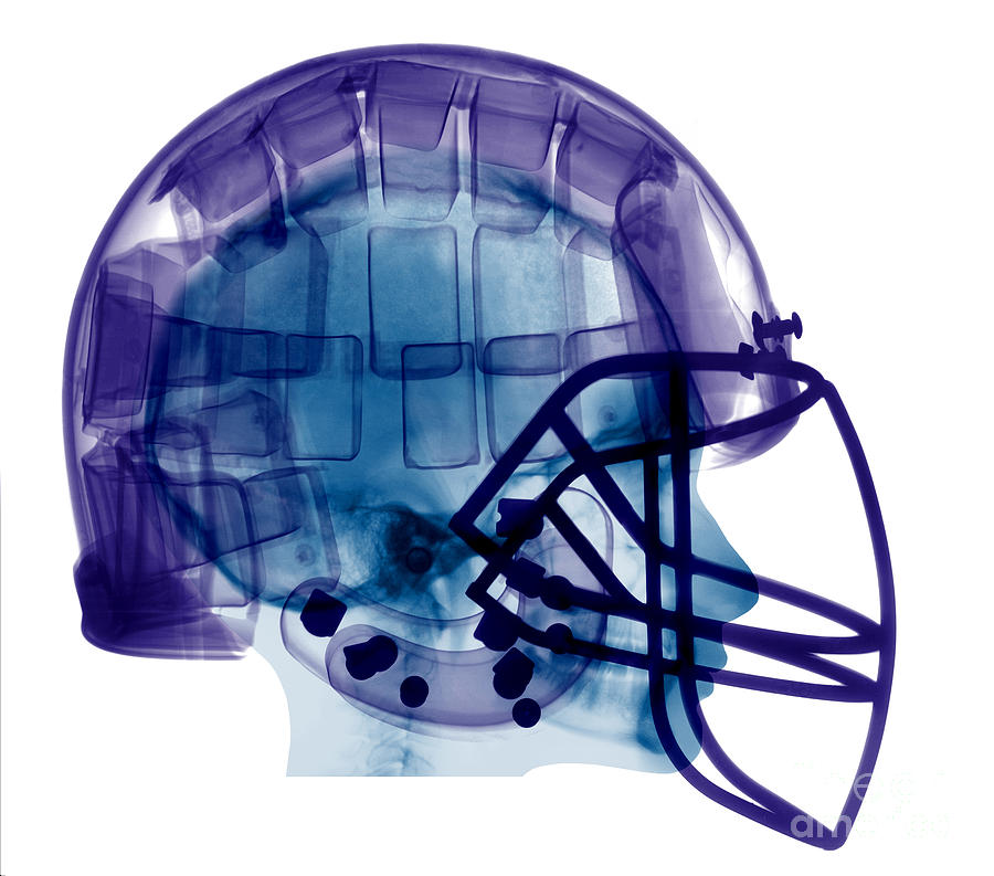 Football Helmet, X-ray #5  by Ted Kinsman