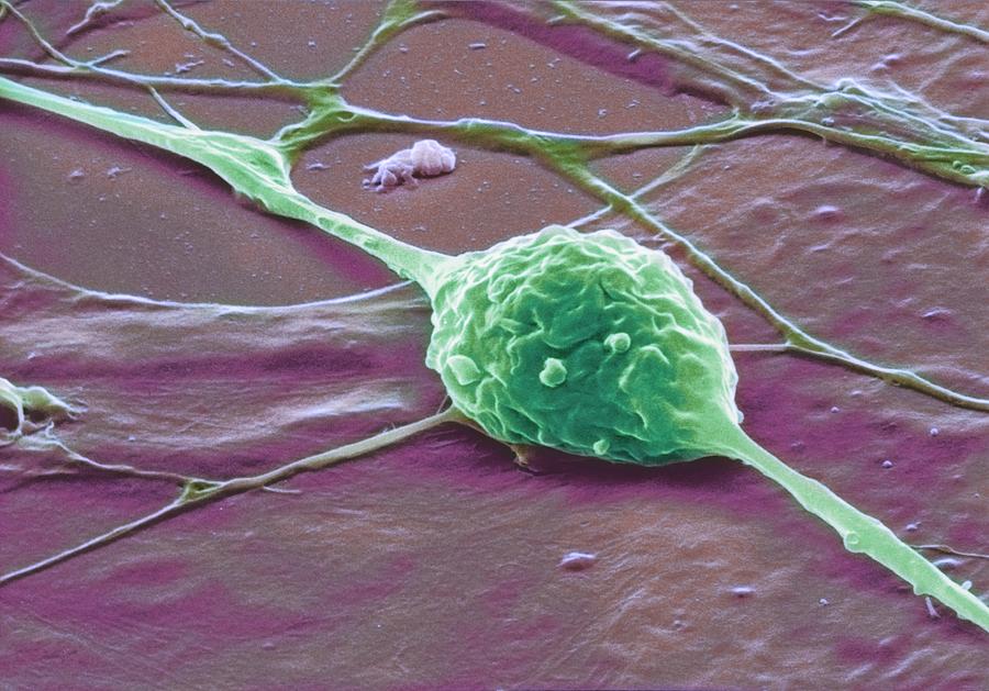 Granule Nerve Cell, Sem #5 Photograph by David Mccarthy