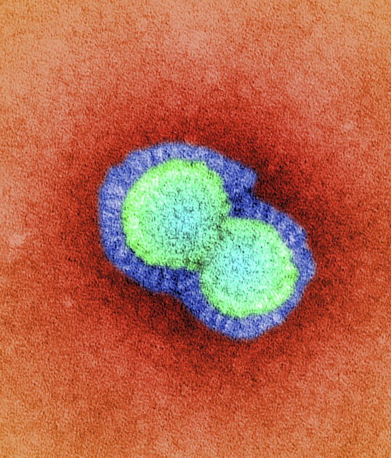 H5n1 Avian Influenza Virus Particles, Tem #5 by Dr Klaus Boller